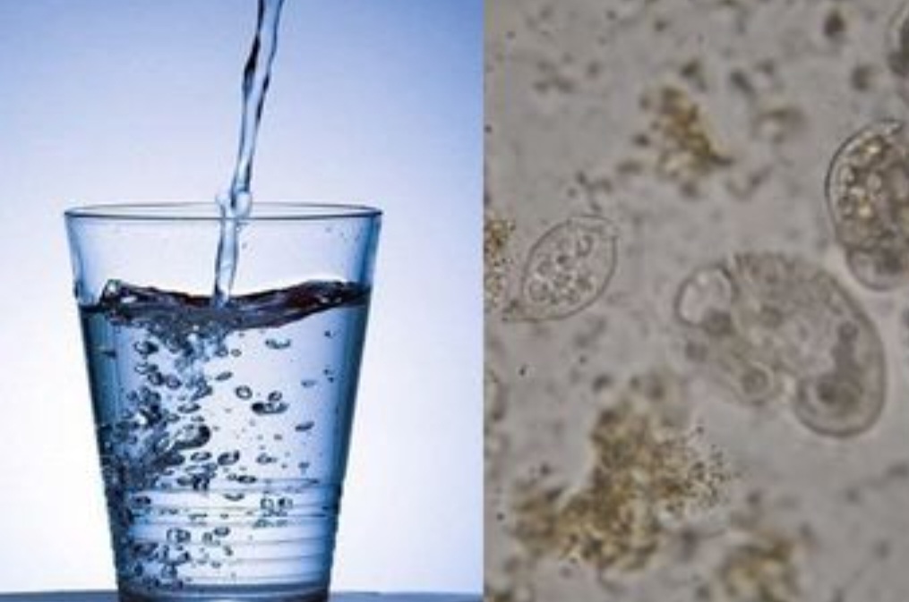 Bakteri dapat Berkembang pada Air Minum yang Kurang Steril Penyimpanannya