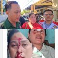 Meminta Kepastian Hukum, Janda Asal Ngoro Mojokerto Korban Penganiayaan Bulan Maret Lalu Datangi Polsek